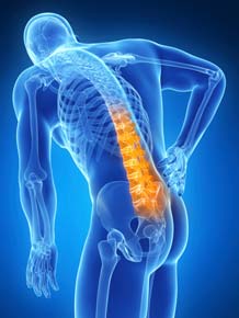 Back Pain - Saratoga Spine